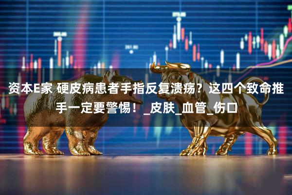资本E家 硬皮病患者手指反复溃疡？这四个致命推手一定要警惕！_皮肤_血管_伤口